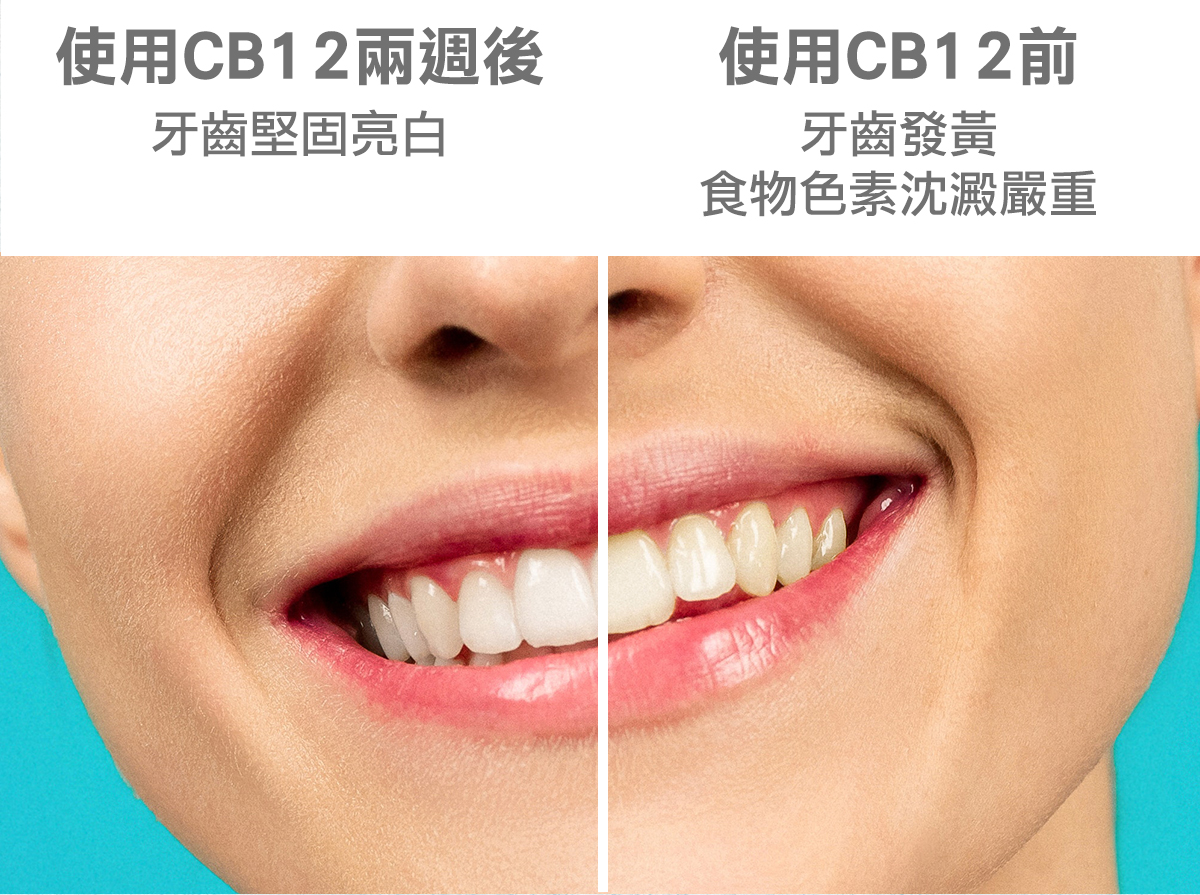 使用cb12兩週後牙齒堅固亮白
